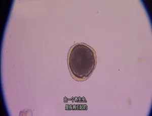 《体内的怪物 病魔缠身》第一季全6集 1080P高清 英语中文字幕1984 愁眉笑脸 中国大陆电影 国语中字