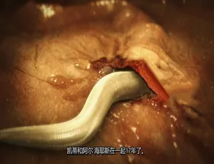 体内的怪物 病魔缠身 第八季 全12集 1080P高清 英语中文字幕纪录片-蓝海网